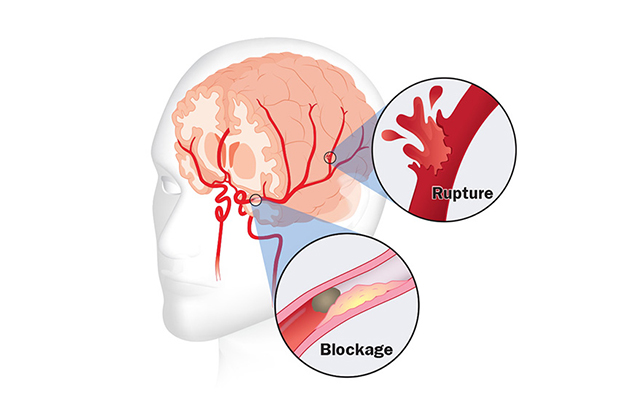 stroke custom illustration